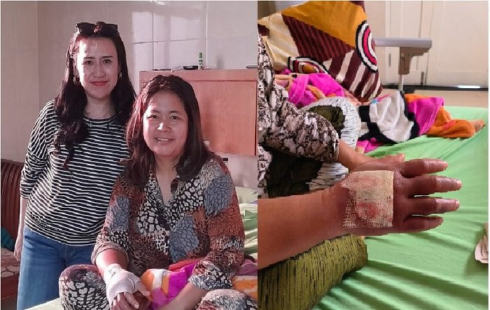 Diduga Jadi Korban Malpraktik RS Urip Sumoharjo, Ayu Rica Akan Lapor Polda